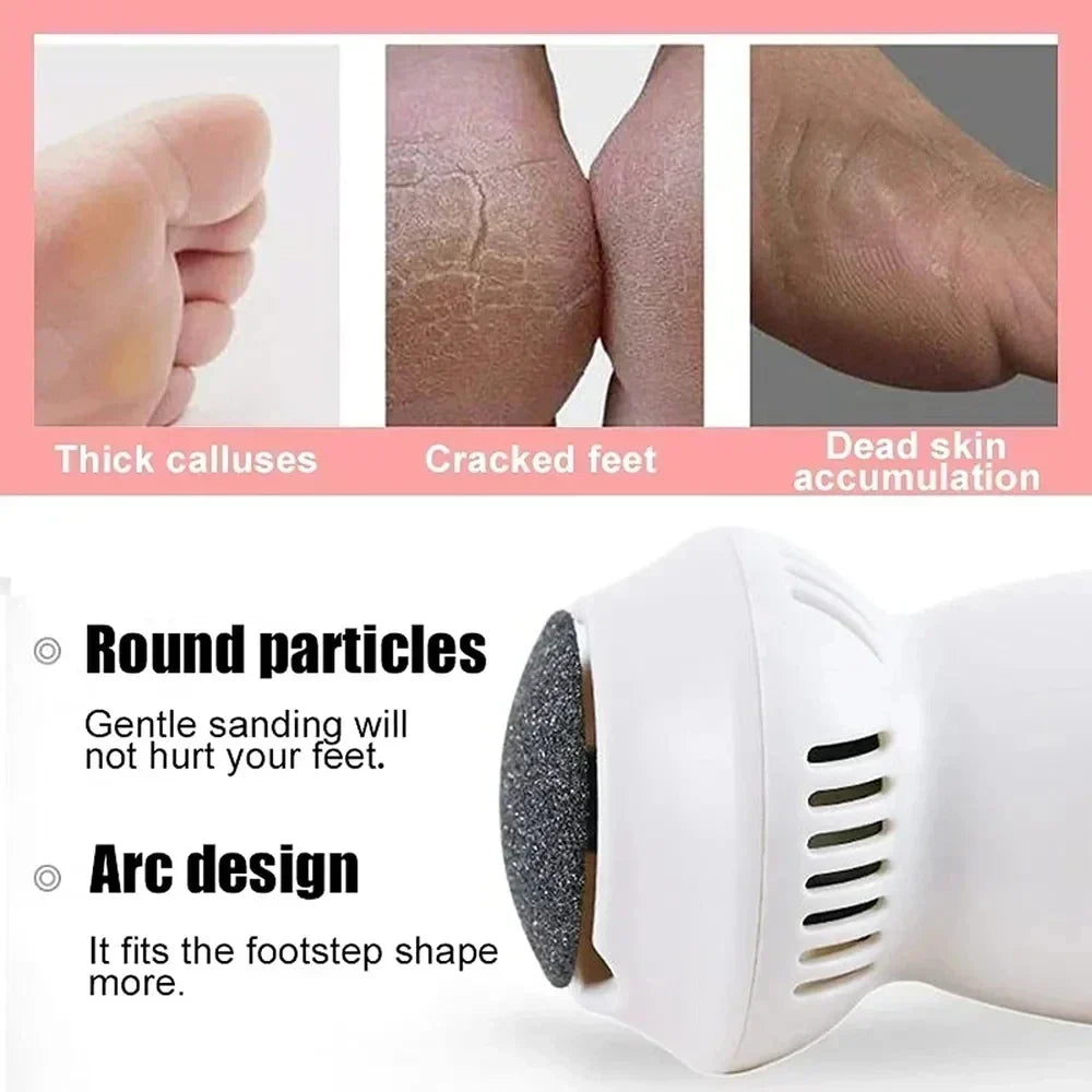 Foot Callus Remover Tool